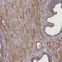 Anti-FILIP1L antibody produced in rabbit 
