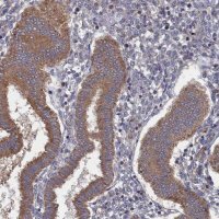 Anti-FILIP1L antibody produced in rabbit 