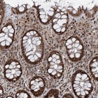 Anti-FKBP5 antibody produced in rabbit 