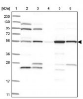 Anti-FKBP5 antibody produced in rabbit 