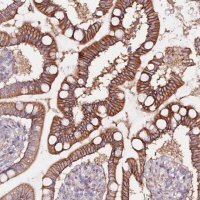 Anti-FLVCR1 antibody produced in rabbit 