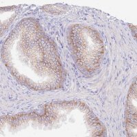 Anti-FLVCR1 antibody produced in rabbit 
