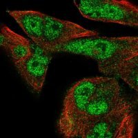 Anti-FMN1 antibody produced in rabbit