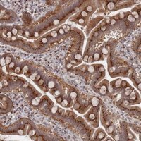 Anti-FMO4 antibody produced in rabbit 