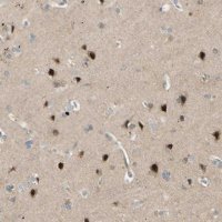 Anti-FNDC3B antibody produced in rabbit 
