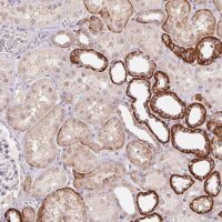 Anti-FNDC4 antibody produced in rabbit 