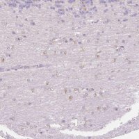 Anti-FOCAD antibody produced in rabbit 