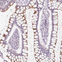 Anti-FOCAD antibody produced in rabbit 