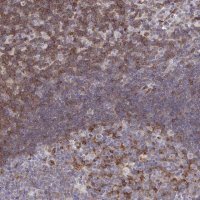 Anti-FOXN3 antibody produced in rabbit 