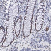 Anti-FOXP2 antibody produced in rabbit 