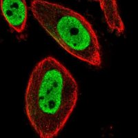 Anti-FOXP3 antibody produced in rabbit 