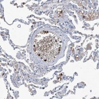 Anti-FPR2 antibody produced in rabbit 