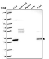 Anti-FRAT1 antibody produced in rabbit HPA055258-100UL