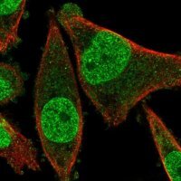 Anti-FRAT2 antibody produced in rabbit 