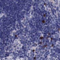 Anti-FRMD1 antibody produced in rabbit 