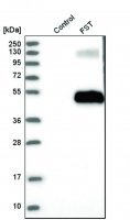 Anti-FST antibody produced in rabbit HPA018155-100UL