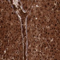 Anti-FTSJ1 antibody produced in rabbit 