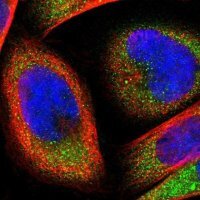Anti-FTSJ1 antibody produced in rabbit 