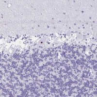 Anti-FTSJ3 antibody produced in rabbit 