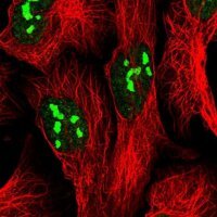 Anti-FTSJ3 antibody produced in rabbit 