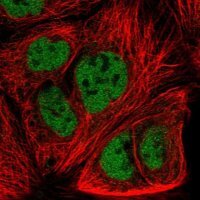 Anti-FZD7 antibody produced in rabbit