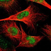 Anti-GABPA antibody produced in rabbit 