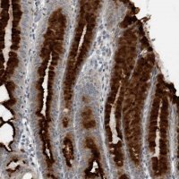 Anti-GAK antibody produced in rabbit 