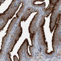 Anti-GAK antibody produced in rabbit 