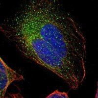 Anti-GAL3ST1 antibody produced in rabbit 