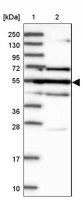 Anti-GAL3ST4 antibody produced in rabbit HPA038137-100UL