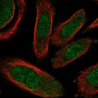 Anti-GALK2 antibody produced in rabbit
