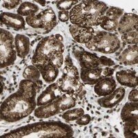 Anti-GALNT1 antibody produced in rabbit