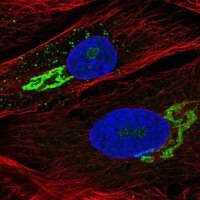 Anti-GALNT5 antibody produced in rabbit 