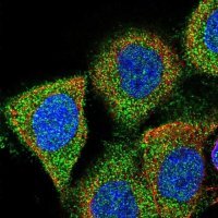 Anti-GAPVD1 antibody produced in rabbit 
