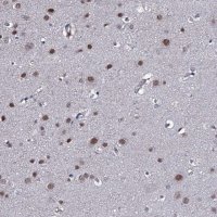Anti-GAREM1 antibody produced in rabbit 