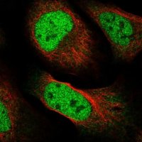 Anti-GAREM1 antibody produced in rabbit 