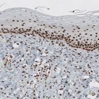Anti-GATA3 antibody produced in rabbit 