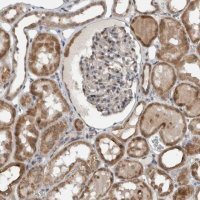 Anti-GBA2 antibody produced in rabbit
