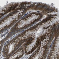 Anti-GDF5 antibody produced in rabbit 