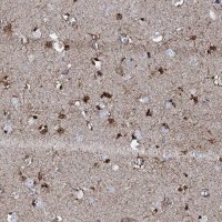 Anti-GFOD2 antibody produced in rabbit 
