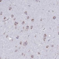 Anti-GFPT2 antibody produced in rabbit HPA059910-100UL