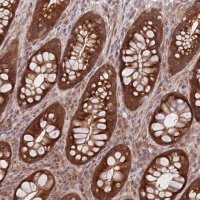 Anti-GGA1 antibody produced in rabbit HPA048280-100UL