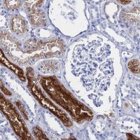Anti-GGT2 antibody produced in rabbit HPA045635-100UL
