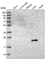 Anti-GGT2 antibody produced in rabbit HPA045635-100UL