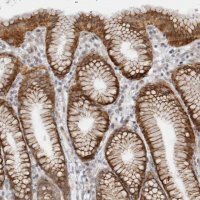 Anti-GGT6 antibody produced in rabbit HPA027213-100UL