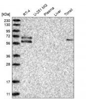 Anti-GGT6 antibody produced in rabbit HPA027213-100UL