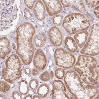 Anti-GHITM antibody produced in rabbit 