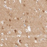 Anti-GIT1 antibody produced in rabbit