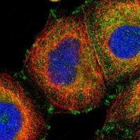 Anti-GIT1 antibody produced in rabbit