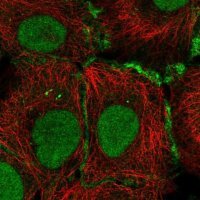 Anti-GJB4 antibody produced in rabbit HPA055112-100UL